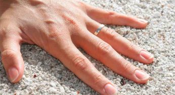 Se fanno male le dita c’è un motivo ben preciso e potrebbe essere una patologia seria